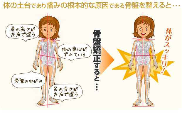体の土台であり痛みの根本的な原因である骨盤を整えると...